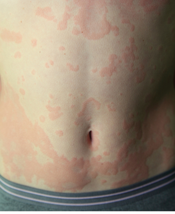 Aesthetische Behandlung Frau