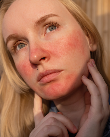 Aesthetische Behandlung Frau